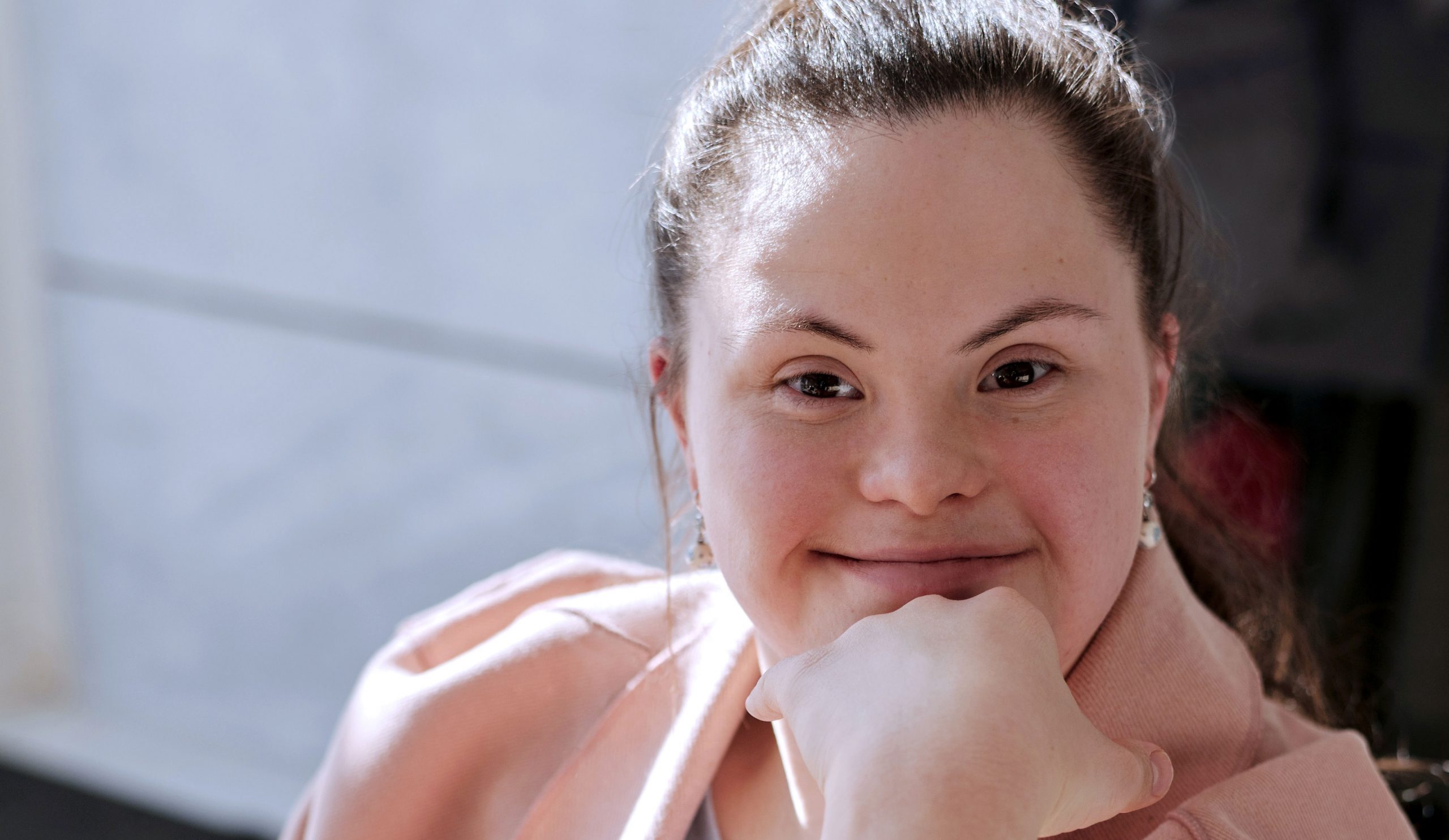 A female with down syndrome smiling